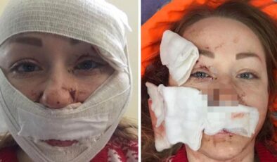 Bakırköy’de eşinin yüzünü falçatayla yaralayan şüpheli tutuklandı