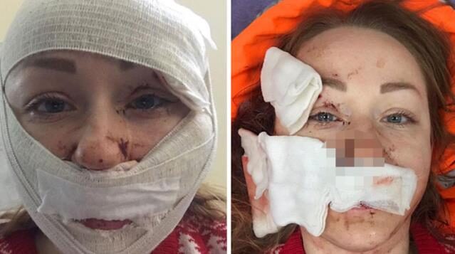 Bakırköy’de eşinin yüzünü falçatayla yaralayan şüpheli tutuklandı