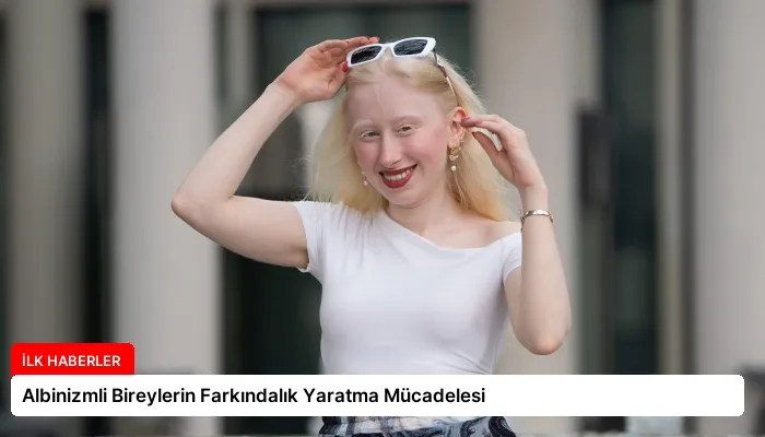 Albinizmli Bireylerin Farkındalık Yaratma Mücadelesi