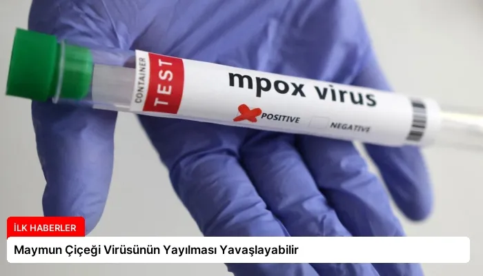 Maymun Çiçeği Virüsünün Yayılması Yavaşlayabilir