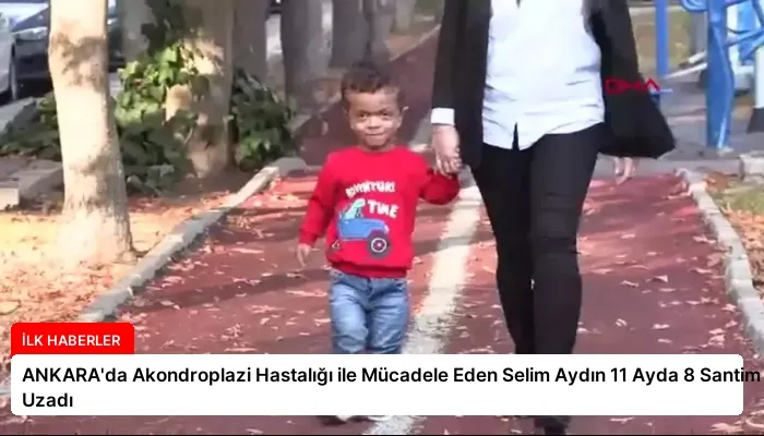 ANKARA’da Akondroplazi Hastalığı ile Mücadele Eden Selim Aydın 11 Ayda 8 Santim Uzadı