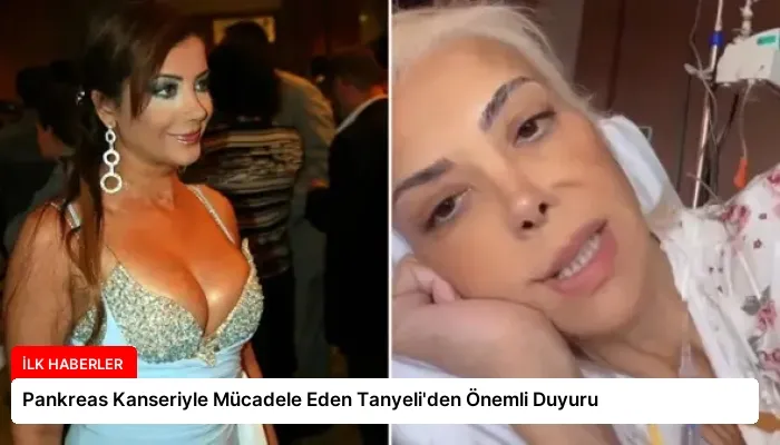 Pankreas Kanseriyle Mücadele Eden Tanyeli’den Önemli Duyuru