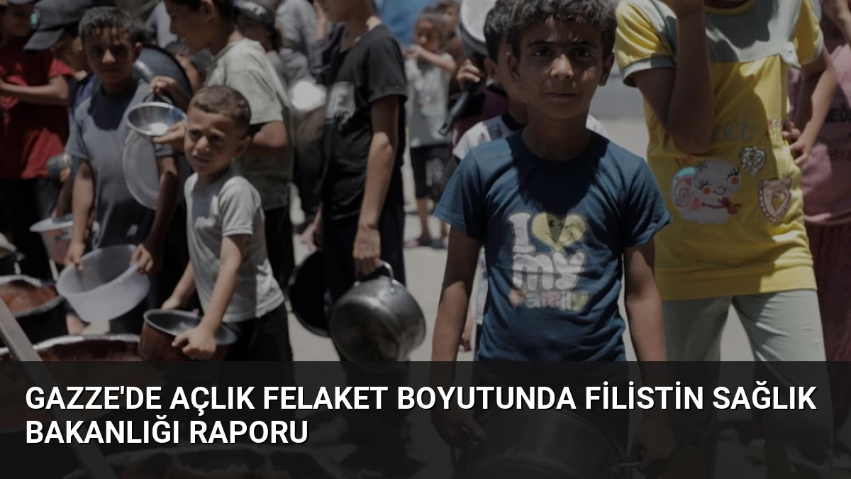 Gazze’de Açlık Felaket Boyutunda Filistin Sağlık Bakanlığı Raporu